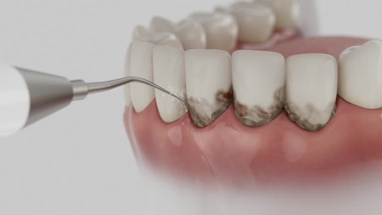 Trusted Dental Crowns And Bridges service in Weleetka, OK - Dentist Open Now